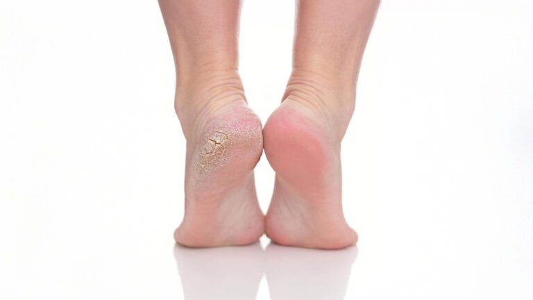 Curso de Pedicuría más Belleza de Pies